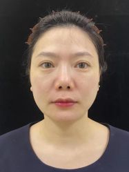 -Yestar重庆艺星医疗美容医院