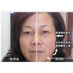 -如新nuskin美容工作室