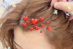 -大麦微针植发全国连锁