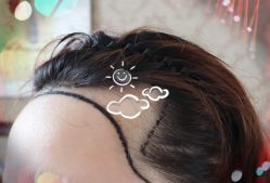 -大麦微针植发全国连锁