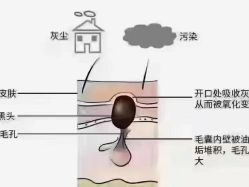 -蕾特恩专业祛痘·皮肤管理