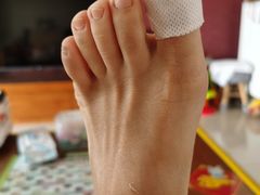 -新甲连锁灰指甲·甲沟炎·鸡眼(黑龙江路店)