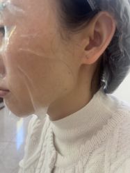 -长沙雅美医疗美容医院