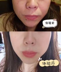 -More摩尔医美の注射线雕光电中心