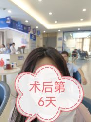 -大麦微针植发全国连锁