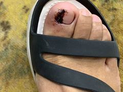 -新甲连锁灰指甲·甲沟炎·鸡眼(黑龙江路店)