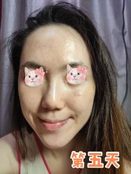 -洁铭新加坡医美