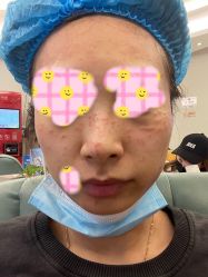 点击看大图 体验后-天津伊美尔医疗整形美容专科医院