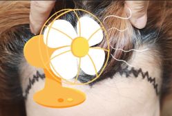 -大麦微针植发全国连锁