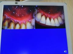 -爱牙联合口腔(门诊报销 海云庵店)