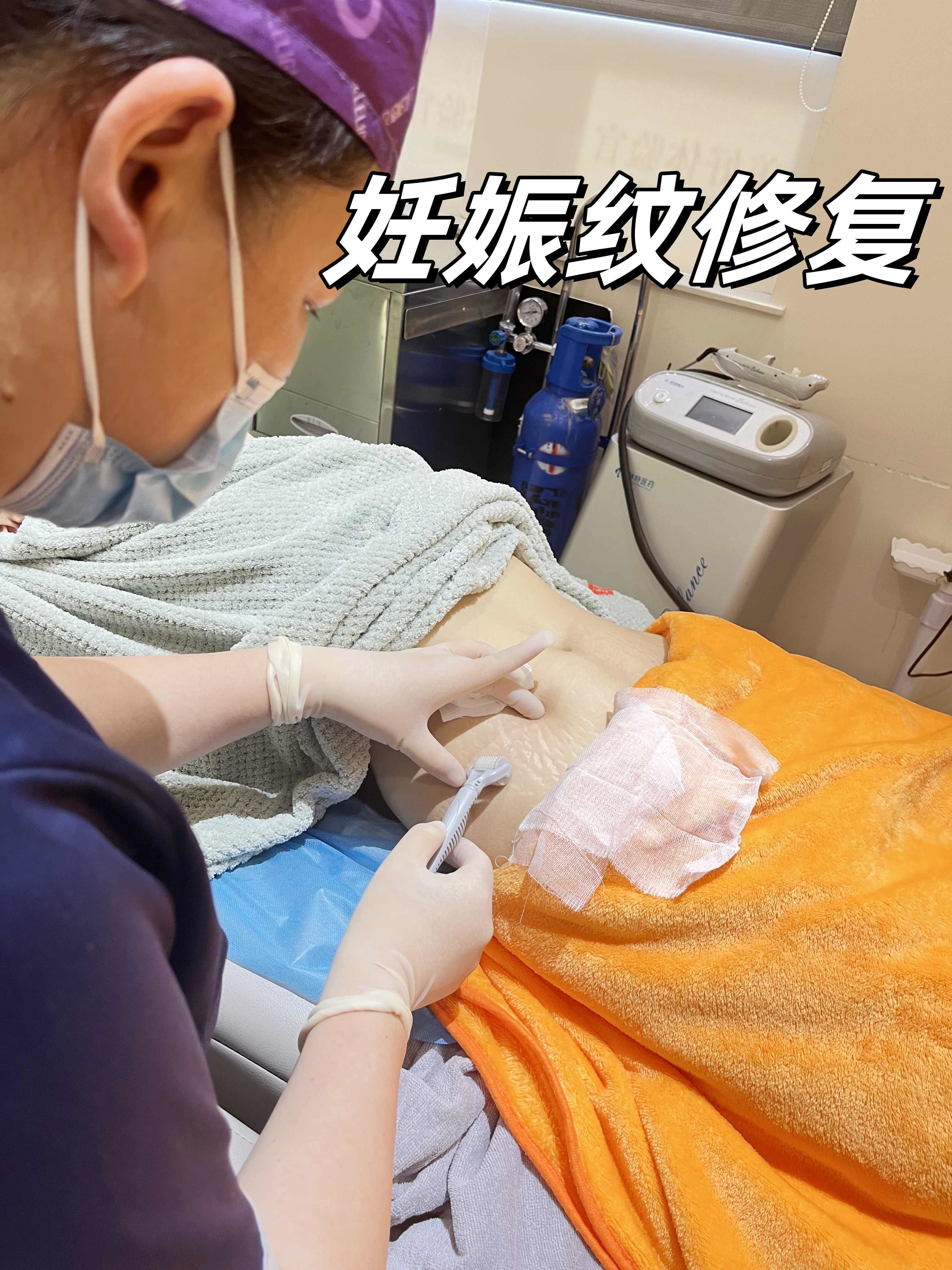 是"勋章"也是"损伤"
#妊娠纹修复 
帮妈妈找回平滑的小蛮腰👙