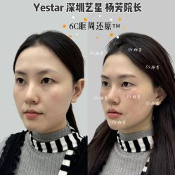 -深圳艺星医疗美容医院