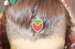 -大麦微针植发全国连锁