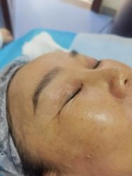 -长沙雅美医疗美容医院