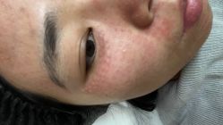 -Yestar艺星整形美容医院