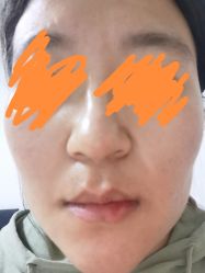 体验后-和颜一美轻医美连锁