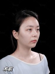 点击看大图 -Yestar重庆艺星医疗美容医院