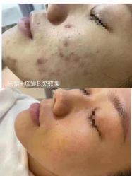 -佳慕·痘痘·问题肌管理中心