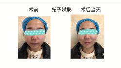 体验前-上海宏康医院·医疗美容科
