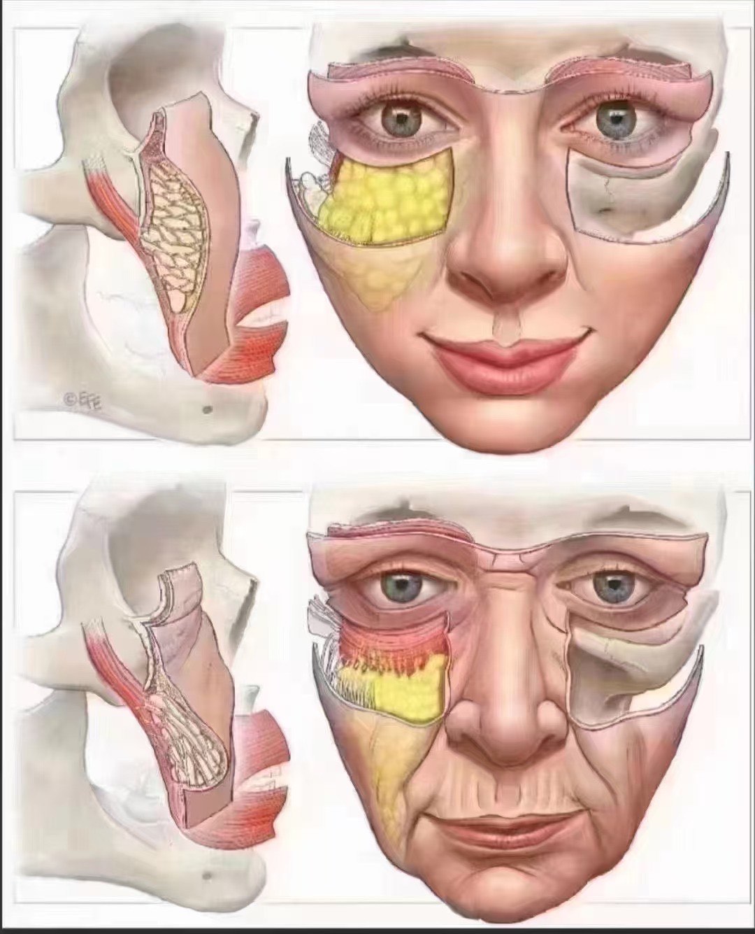 面部骨骼衰老图图片