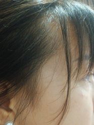 点击看大图 -广州美莱医疗美容医院
