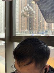 -碧莲盛·不剃发植发