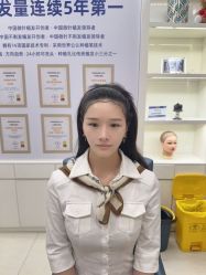 -大麦微针植发丨全国连锁