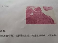 -天津医科大学肿瘤医院(本部院区)