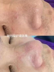 点击看大图 -蕾特恩专业祛痘·皮肤管理