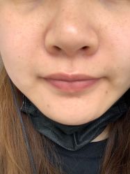 -苗方清颜专业祛痘连锁机构