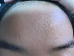 点击看大图 -予初皮肤管理中心