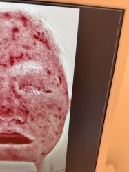 -苑苑vbeauty科技美容SPA