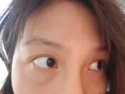 体验前-紫洁俪方（北京）医疗美容