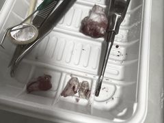 -上海仁爱医院口腔科 · 种植