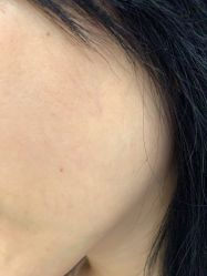 -美瑞莎创美医疗美容