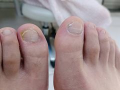 -新甲连锁灰指甲·甲沟炎·鸡眼(黑龙江路店)