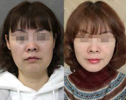 -加减美医美连锁品牌