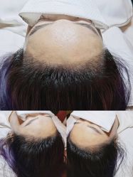 -西施无菌半永久纹绣眉眼影唇轻增发纹发际线