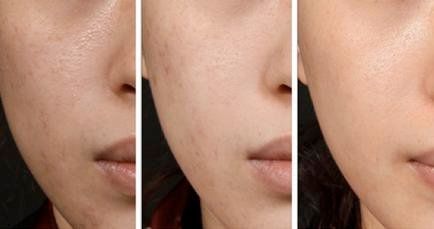 -SKINIST丽铂医疗美容