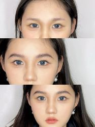 点击看大图 -杨益美学·野生眉半永久纹眉发际线