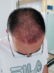 -雍禾植发全国连锁