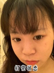 体验后-南宁华美医疗美容医院