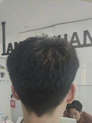-天使之手