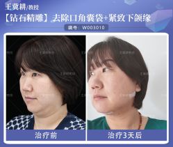-丰联丽格医疗美容·联合丽格眼整形中心