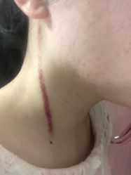 -安那般那皮肤年轻化ANAPANA