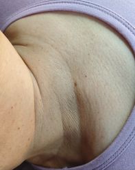 -清疣美疣·痣·斑净肤中心
