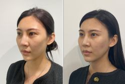 体验前-美莱医学美容医院
