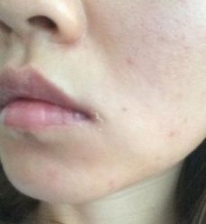 -SKINIST丽铂医疗美容