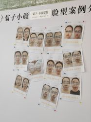 -菊子小颜·日式整骨·产后管理