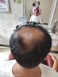 -唐风采假发补发定制